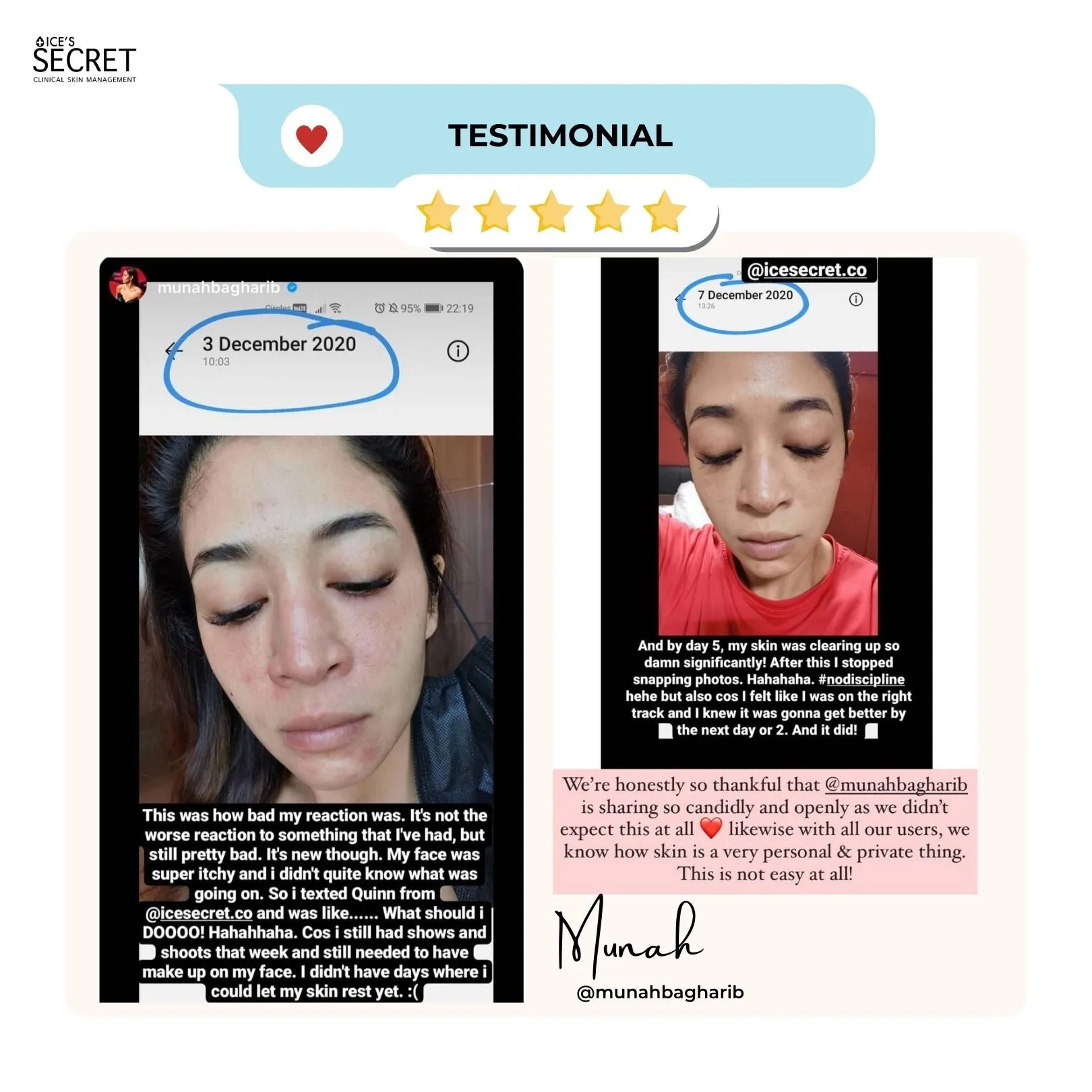 Anti-Blemish, Lighten Scars Kit